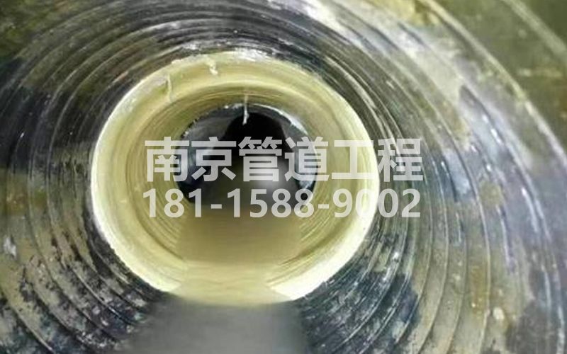 尧安新村树脂修复